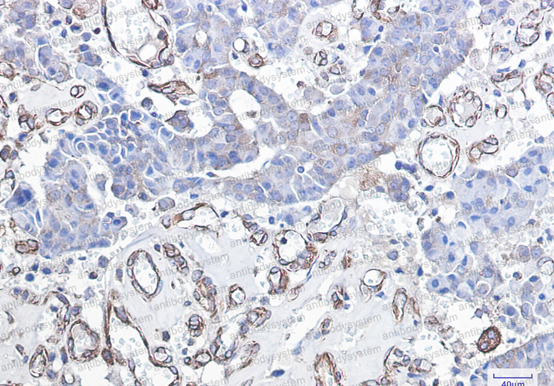 Anti-CHOP/GADD153/DDIT3 Antibody (R1V22)