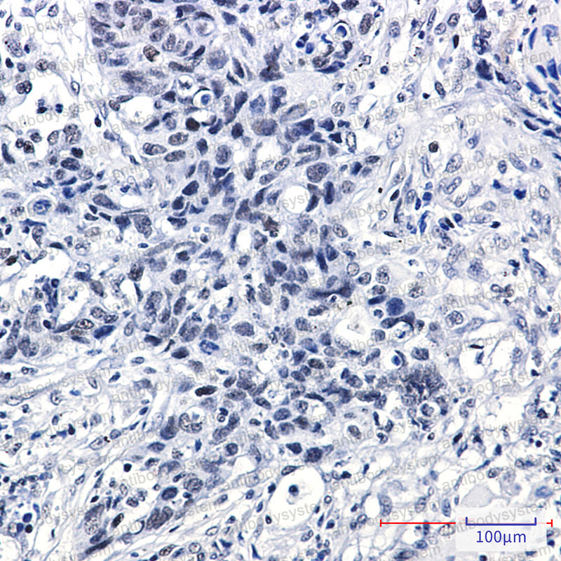 Anti-DEK Antibody (R1V24)