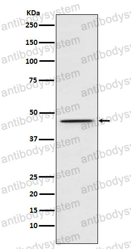 Anti-DEK Antibody (R1V23)