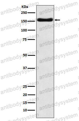 Anti-ATP7B Antibody (R1V25)