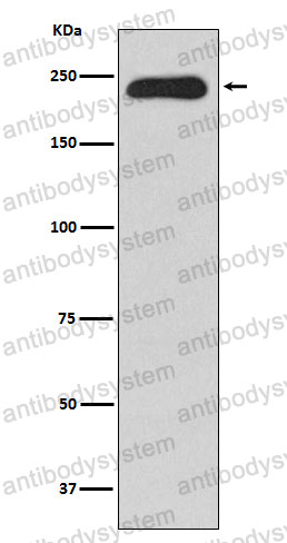 Anti-MYH11 Antibody (R1V26)