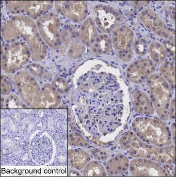 Anti-PPM1A Antibody (R3J95)