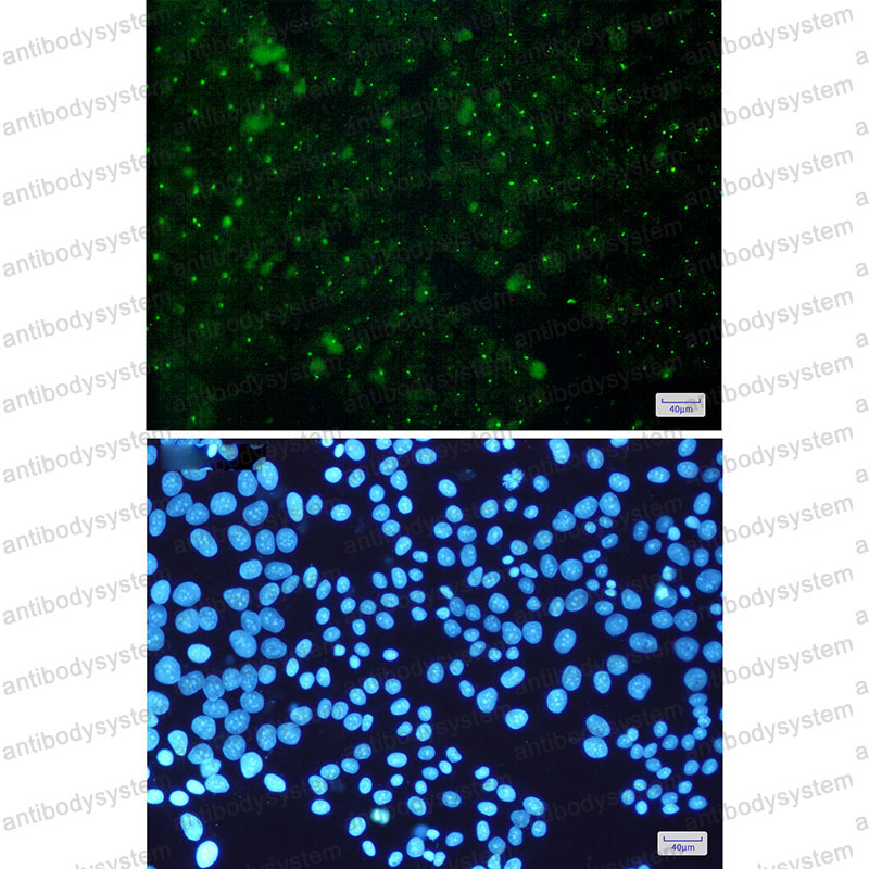 Anti-AHR Antibody (R1V28)