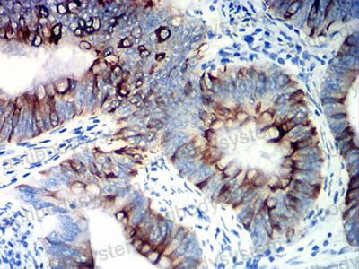 Anti-KRT20 Antibody (R3J96)
