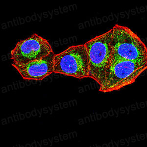 Anti-KRT2 Antibody (R3J98)