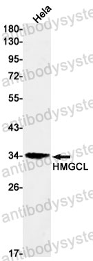Western blot for Anti-HMGCL Antibody (R1V30) ?>