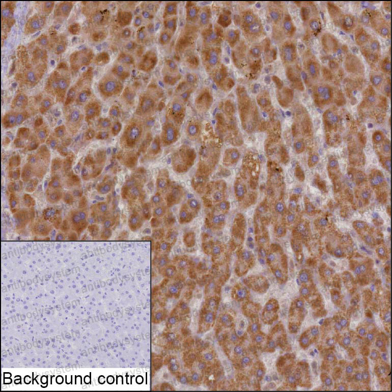 Anti-CHI3L1 Antibody (R3K02)