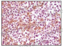Anti-SNCA/Alpha-synuclein Antibody (R3K13)