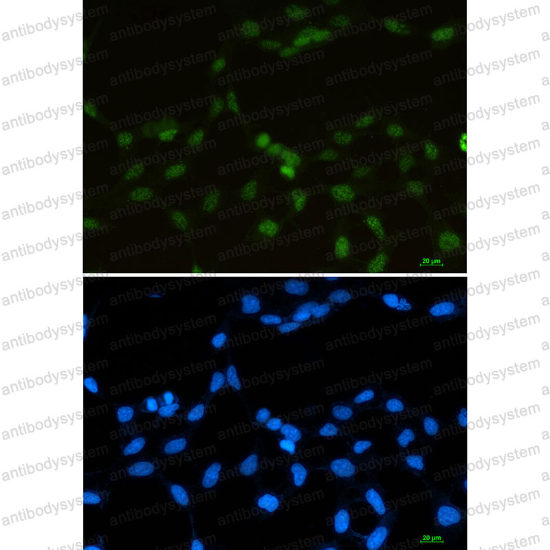 Anti-RBMX Antibody (R1V49)