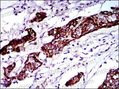 Anti-BRCA1 Antibody (R3K14)