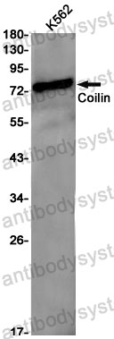 Anti-COIL Antibody (R1V51)
