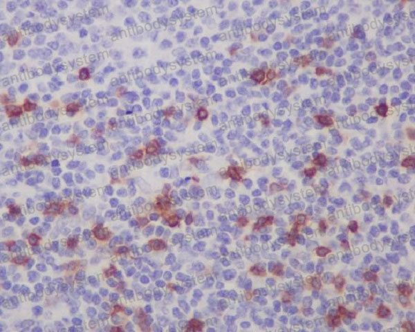 Anti-CD103/ITGAE Antibody (R1V52)