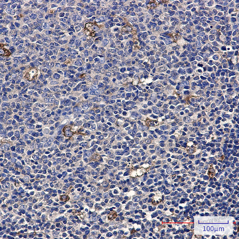 Anti-ATP6V1A Antibody (R1V54)