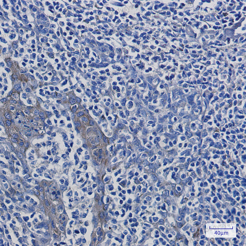 Anti-ATP6V1A Antibody (R1V53)