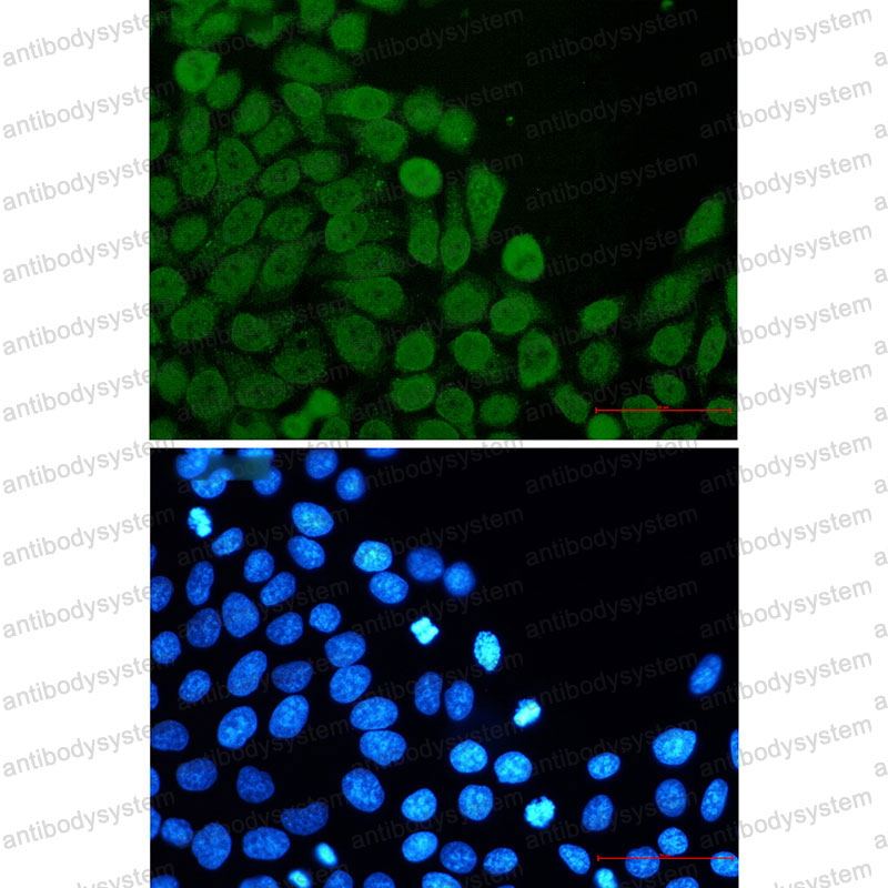 Anti-EIF4A3 Antibody (R1V57)