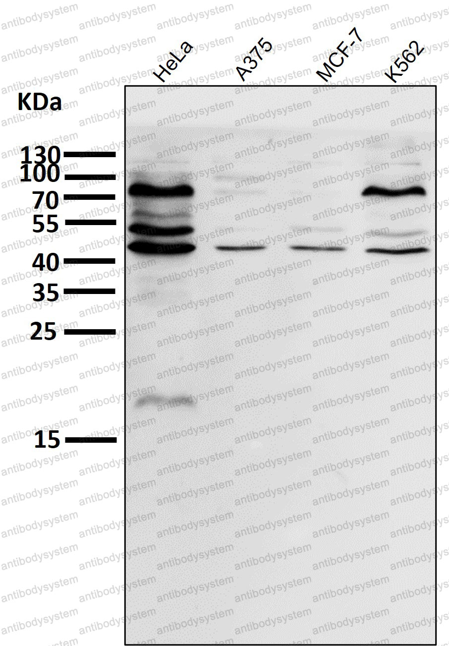Anti-EIF4A3 Antibody (R1V56)