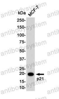 Anti-CDKN1A/p21 Antibody (R1V58)