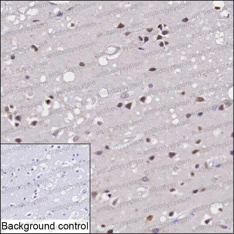 Anti-GDNF Antibody (R3K21)