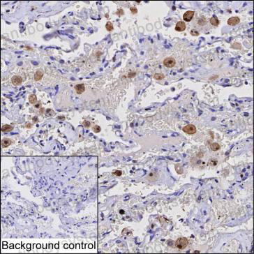 Anti-CAPG Antibody (R3K22)