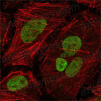Anti-MLH1 Antibody (R3K35)