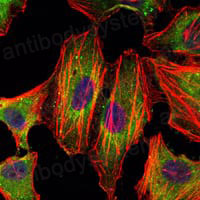 Anti-STAT3 Antibody (R3K41)