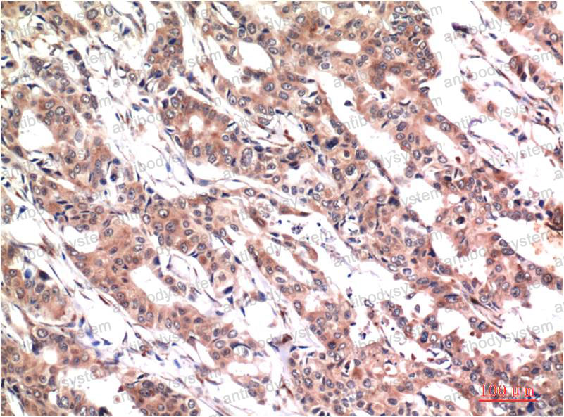 Anti-Phospho-STAT3 (Tyr705) Antibody (R3K42)