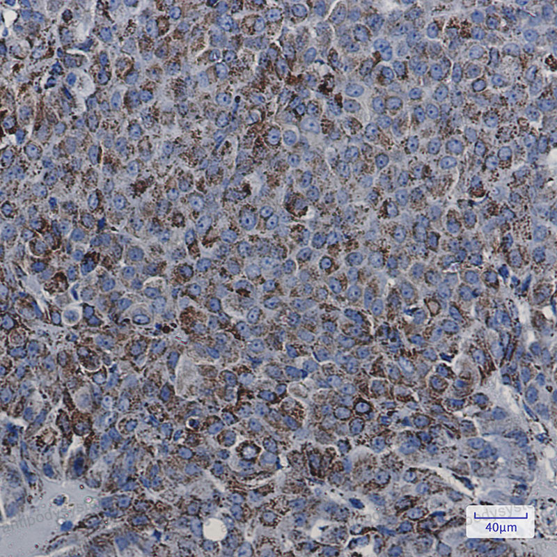 Anti-MDH2 Antibody (R1V80)