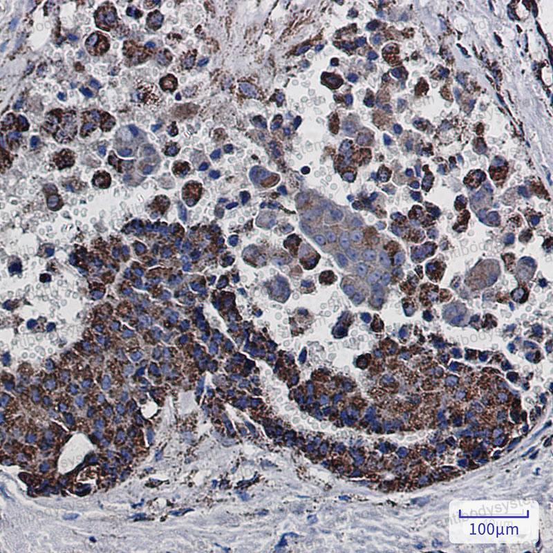 Anti-MDH2 Antibody (R1V79)