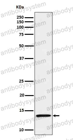 Anti-IL15 Antibody (R1V81)