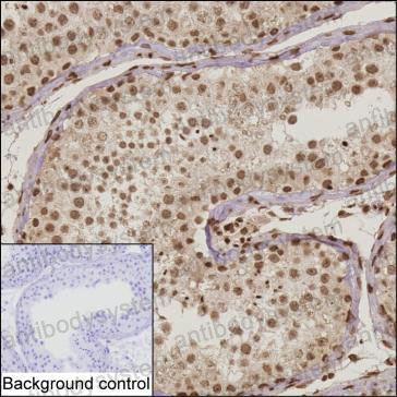 Anti-IL15 Antibody (R3K44)