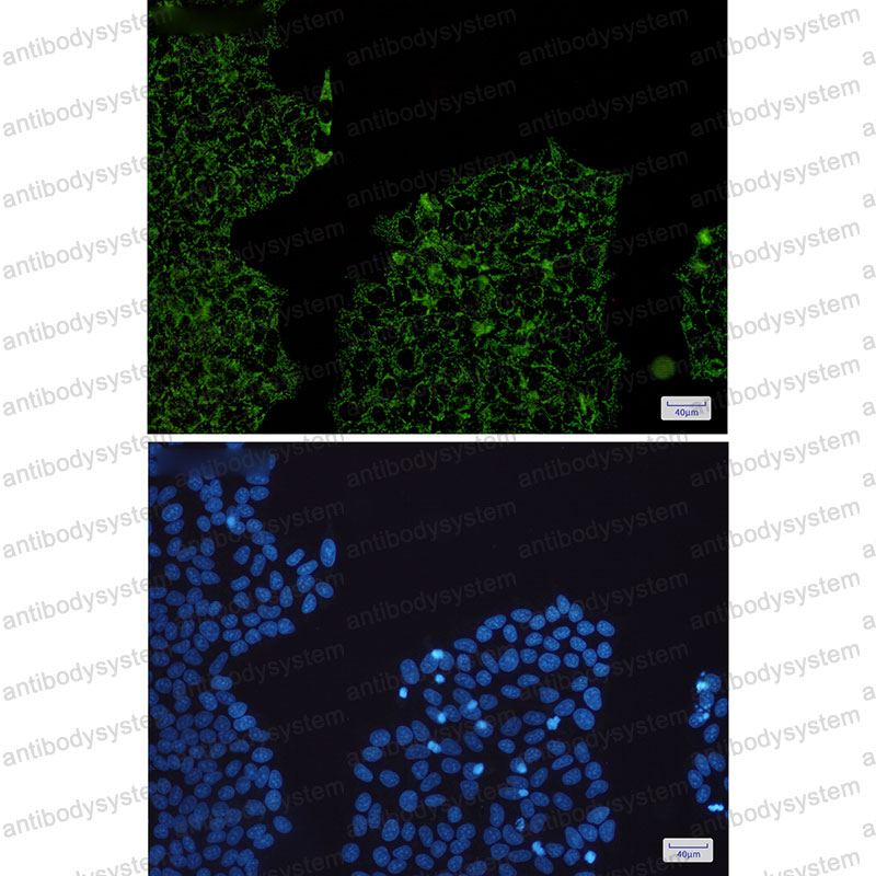 Anti-HADHA Antibody (R1V82)