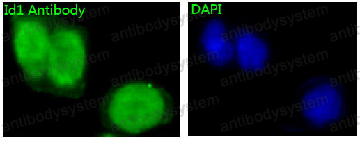 Anti-ID1 Antibody (R1A41)