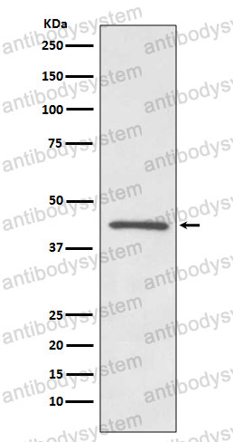 Anti-OPRD1 Antibody (R1V83)