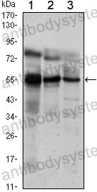 Anti-ETV5/ERM Antibody (R3K48)