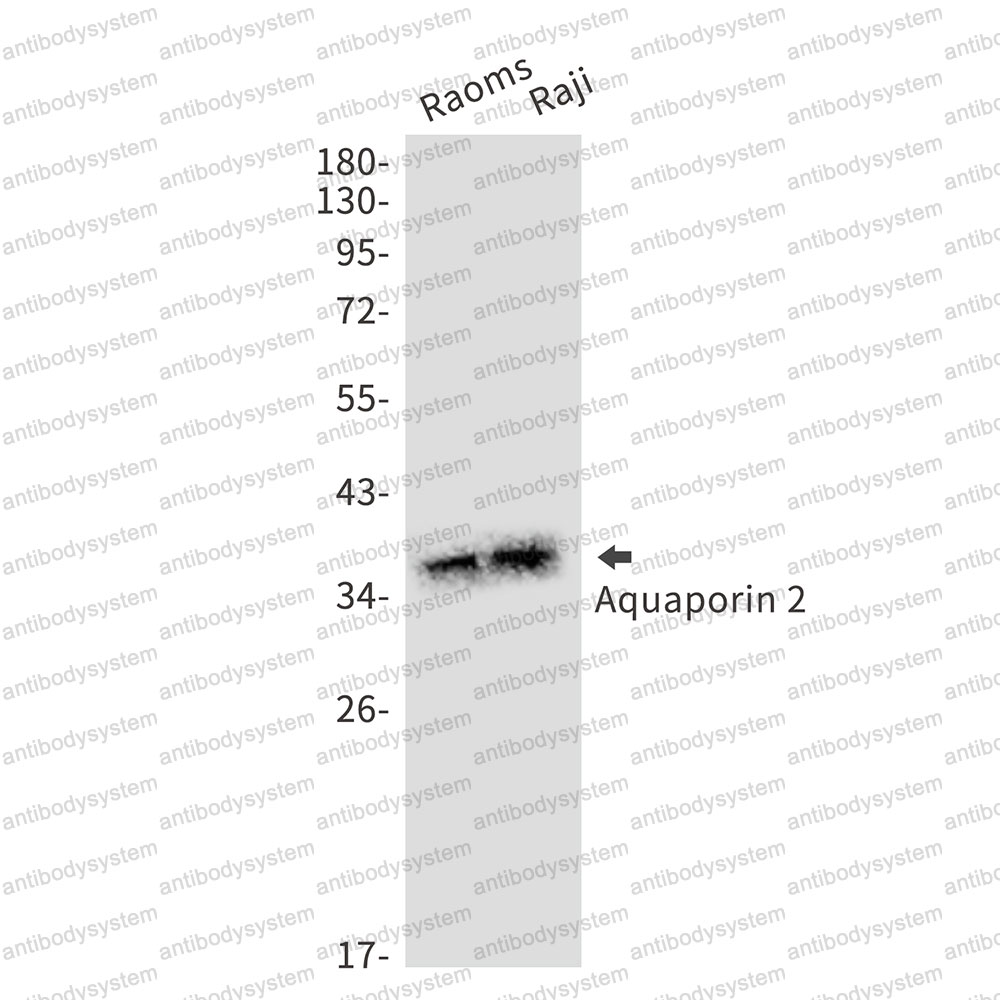 Anti-AQP2 Antibody (R1V85)