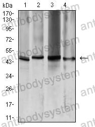 Anti-AQP2 Antibody (R3K49)