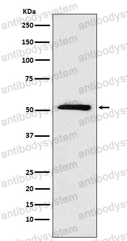 Anti-ETV6 Antibody (R1V86)