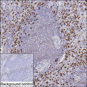 Anti-MNDA Antibody (R3K53)