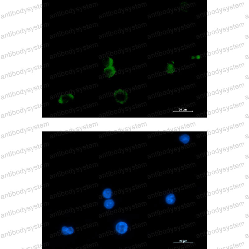 Anti-PTGDS Antibody (R1V88)