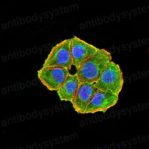 Anti-NAA10 Antibody (R3K56)