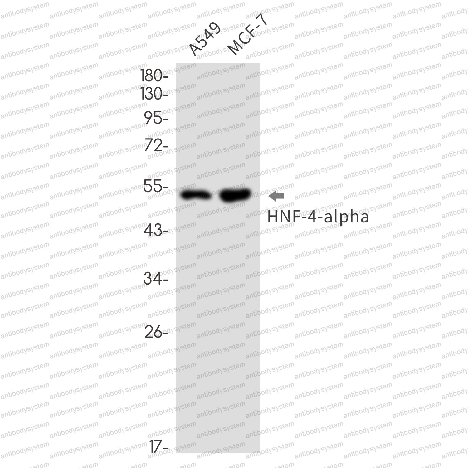 Anti-HNF4A Antibody (R1V92)