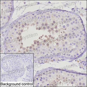 Anti-PPP1R2 Antibody (R3K60)