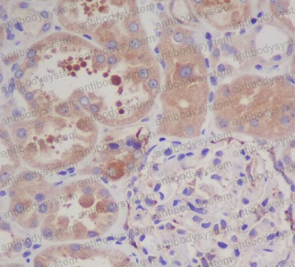 Anti-GARS1/Glycyl-tRNA synthetase Antibody (R1V93)