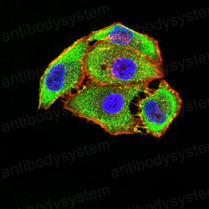 Anti-GRM5 Antibody (R3K64)