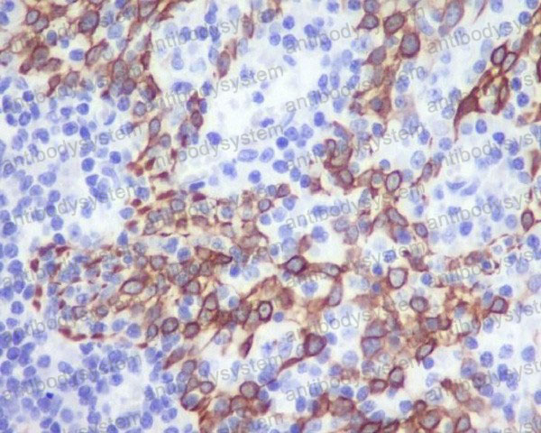 Anti-CD192/CCR2 Antibody (R1A25)