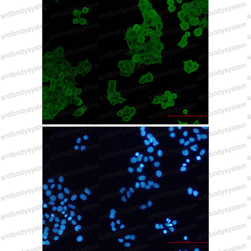 Anti-ACTR1B Antibody (R1V95)