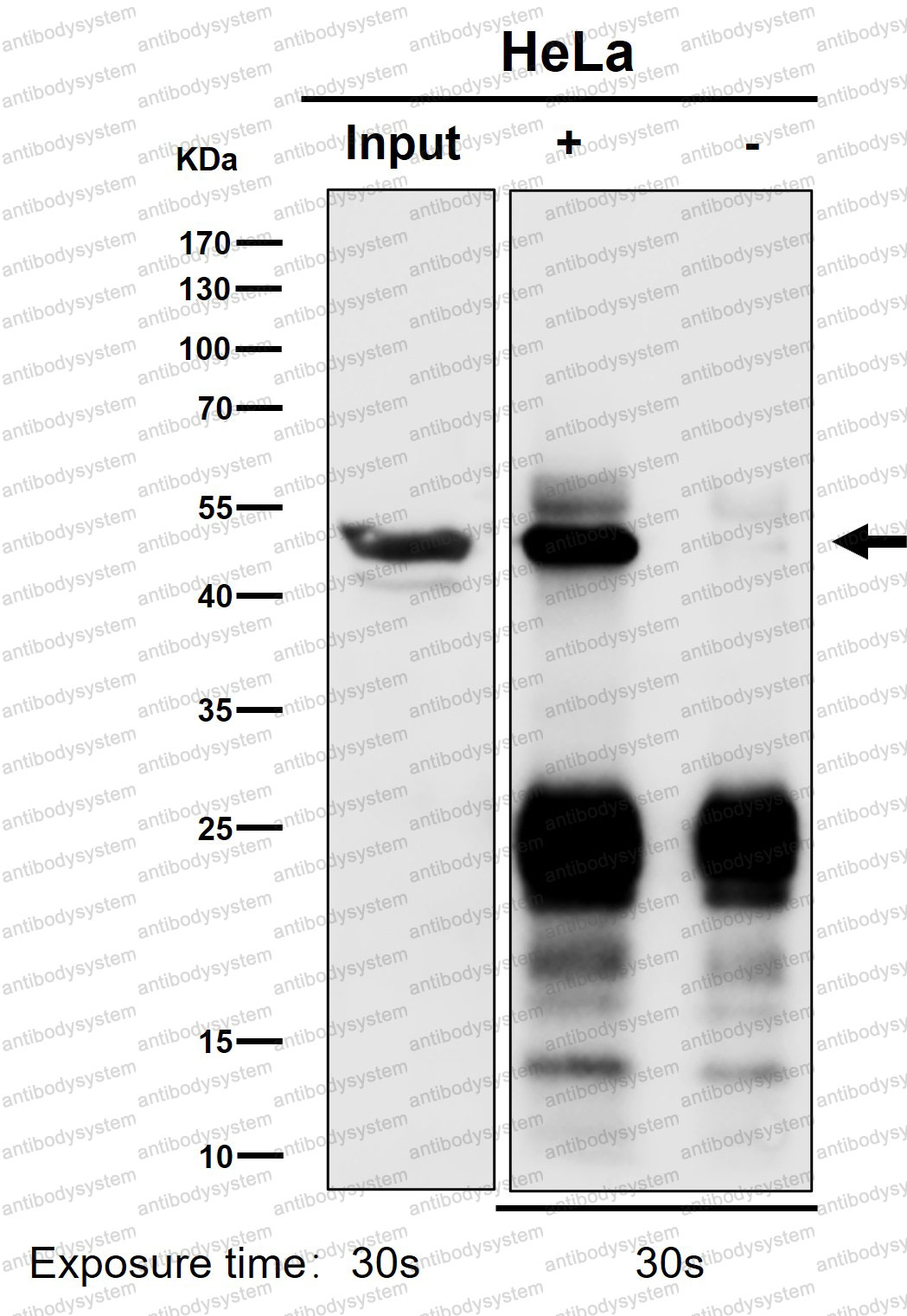 Anti-ACTR1B Antibody (R1V94)