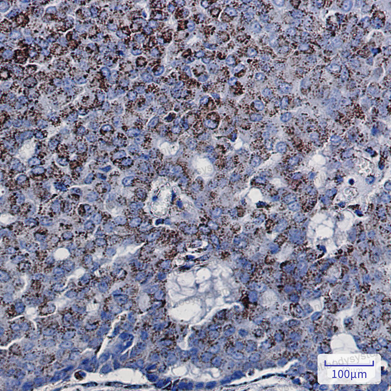 Anti-ECI1 Antibody (R1V96)