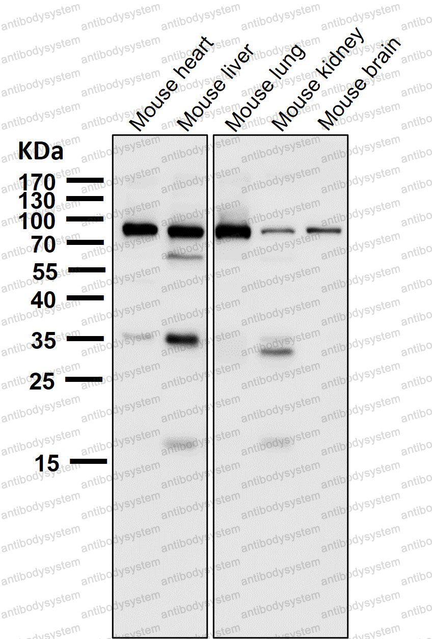 Anti-STAT1 Antibody (R1A95)