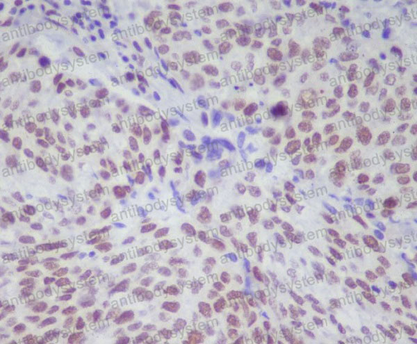 Anti-Phospho-STAT1 (S727) Antibody (R1V97)